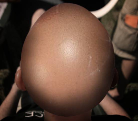 Egg Head