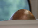 Peeking Bald