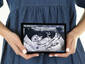Mobile Ultrasound