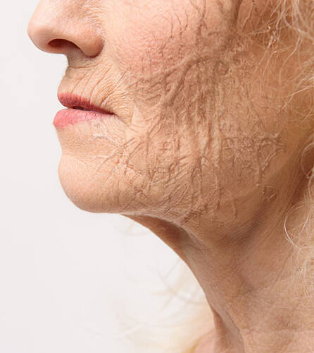 Skin Condition