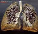 scanned lungs