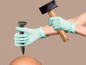 Brain Surgery?
